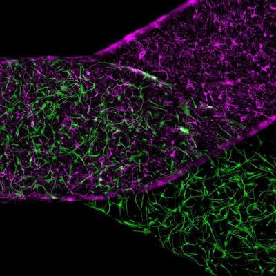 Blood-Brain Barrier Defect Recreated Outside the Body