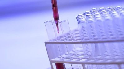 How Clinical Labs Can Adapt to Reimbursement Cuts