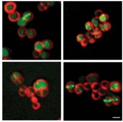 Pseudomonas aeruginosa-produced rhamnolipids target the plasma membrane of Staphylococcus aureus