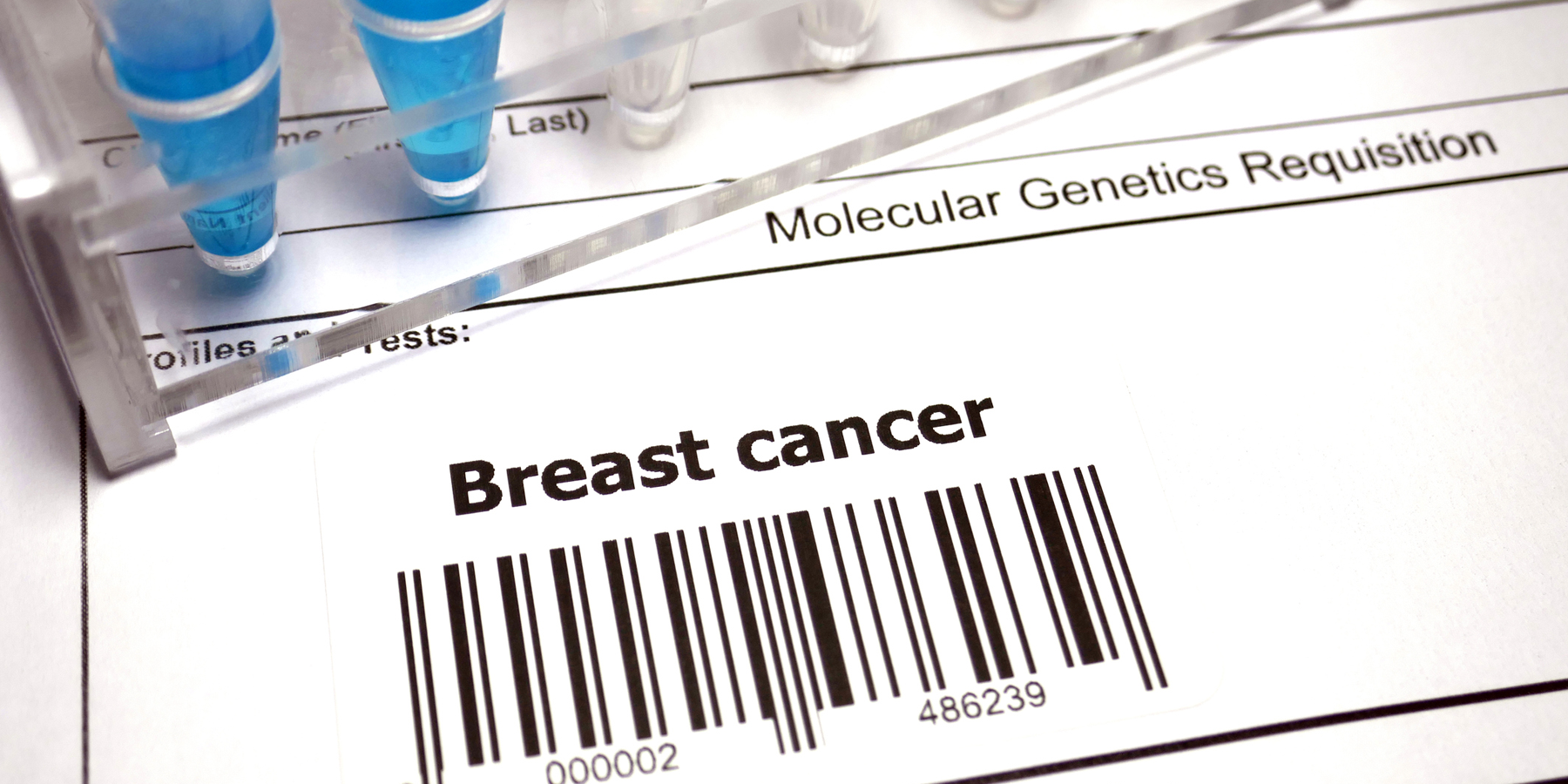 molecular genetics test for breast cancer molecular genetics test for breast cancer