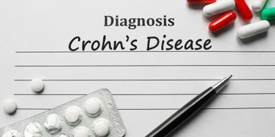 Crohn's Disease Diagnoses