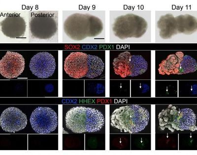 These confocal microscope images depict the key moments that gut organoids begin to take shape