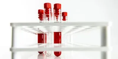 Blood samples in a rack