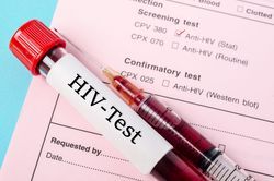 Why the Laboratory Is at the Forefront of the Global Fight against HIV