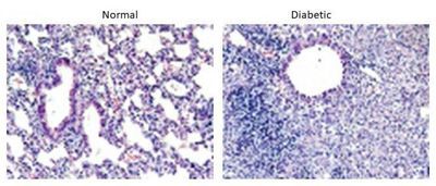Inflammation in Lungs of Diabetic Mouse