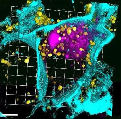 Nanoparticles fighting cancer