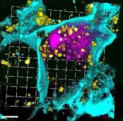 Nanoparticles fighting cancer