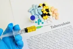 A new clinical practice guideline for treatment of MDR-TB