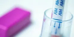 HIV self-test