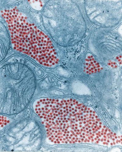 Colorized Image of Mosquito Salivary Gland Tissue Infected by the Eastern Equine Encephalitis Virus