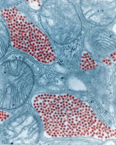 Colorized Image of Mosquito Salivary Gland Tissue Infected by the Eastern Equine Encephalitis Virus