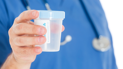 New Urine Dipstick Test Detects Cause of Disease That Blinds Millions