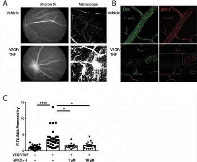 A Potential New Way to Treat Some of the Most Common Blinding Diseases