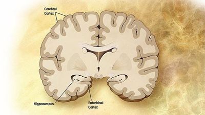 New Method Enables Accurate Diagnosis of Alzheimer&#39;s Disease