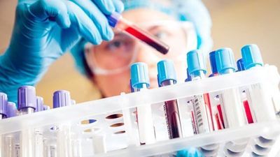 Mayo Researchers Develop New Genetics-Based Prognostic Tool for Myelodysplastic Syndrome