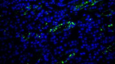 Viruses Under the Microscope