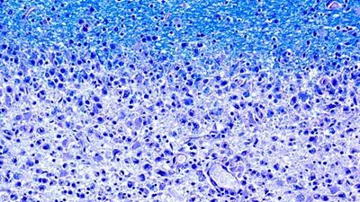 Link Between Gut Flora and Multiple Sclerosis Discovered