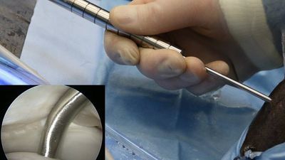 Accurate Evaluation of Chondral Injuries by Near Infrared Spectroscopy