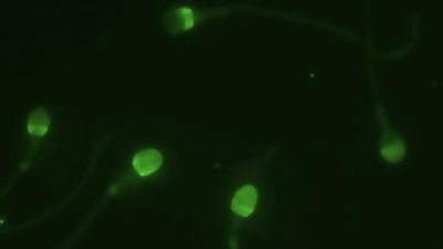 New Test Measures Men&#39;s Fertility