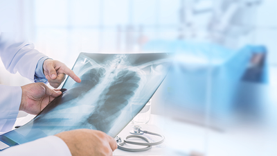 AI May Fall Short When Analyzing Data Across Multiple Health Systems