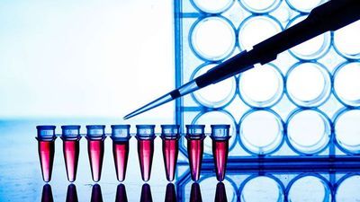 Speed and Sensitivity Give qPCR the Leg Up in Certain Clinical Cases