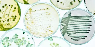 Photo of bacterial cultures in petri dishes