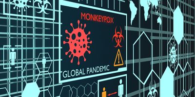 Monkeypox in the Clinical Lab