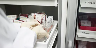 Preparing blood samples related to sickle cell disease treatment