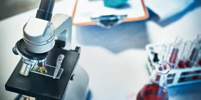 Microscope on a lab table, symbolizing cancer diagnosis