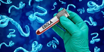 Laboratory testing for Ebola outbreak detection and diagnosis