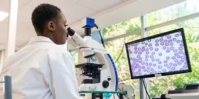 Lab worker examines a tissue sample under a microscope, with a magnified pathology slide image displayed on a screen in the background.