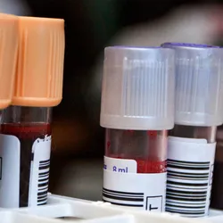 Collection of blood vials for decentralized testing