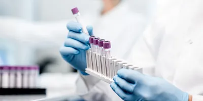 Gloved laboratory professional handling blood sample tubes in a clinical diagnostics lab