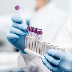 Gloved laboratory professional handling blood sample tubes in a clinical diagnostics lab