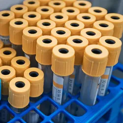 Collection of test tubes for genetic testing in newborn screening.