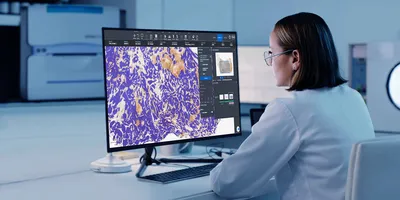 Image of lab worker viewing pathology data