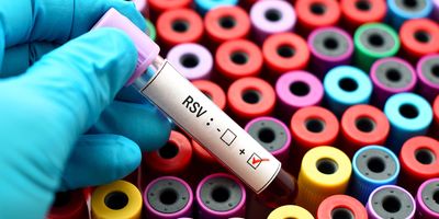 A gloved hand holds a blood vacutainer with RSV checked positive against a bunch of vacutainers in the background.