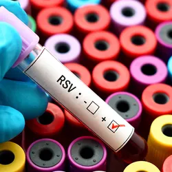 A gloved hand holds a blood vacutainer with RSV checked positive against a bunch of vacutainers in the background.