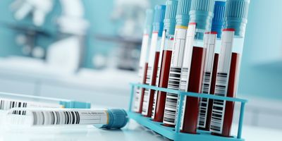 A test tube rack with blood samples in vacutainers with bar codes stuck on them.