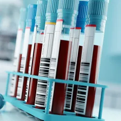 A test tube rack with blood samples in vacutainers with bar codes stuck on them.