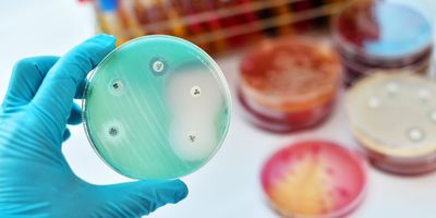 A gloved hand holds a Petri plate with bacterial colonies and antibiotic discs for susceptibility testing.