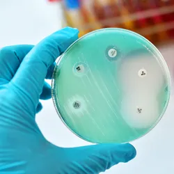 A gloved hand holds a Petri plate with bacterial colonies and antibiotic discs for susceptibility testing.