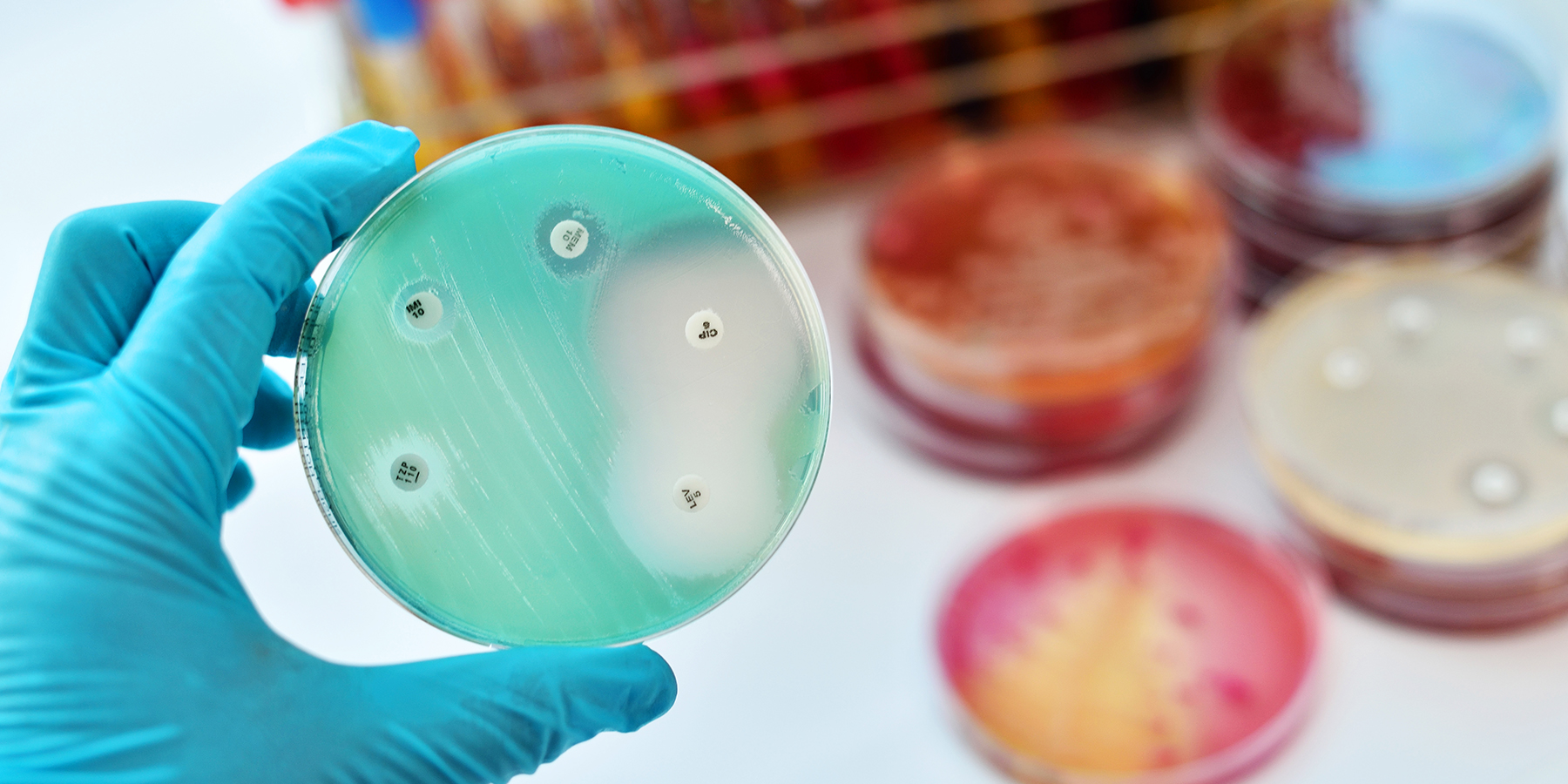 new-antibiotic-resistant-bacterial-species-identified A gloved hand holds a Petri plate with bacterial colonies and antibiotic discs for susceptibility testing.