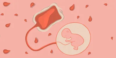 A vector illustration of storing umbilical cord blood cells.