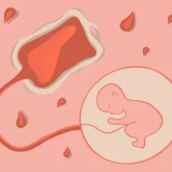 A vector illustration of storing umbilical cord blood cells.
