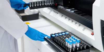 A gloved hand loads prepped samples into a liquid chromatography instrument. 