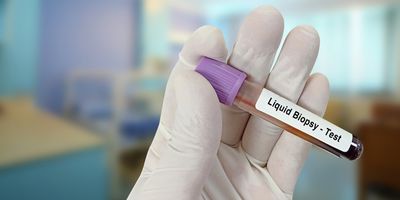 A gloved hand holds a blood vacutainer with "Liquid biopsy- test" sticker stuck on it. 