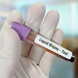 A gloved hand holds a blood vacutainer with "Liquid biopsy- test" sticker stuck on it. 