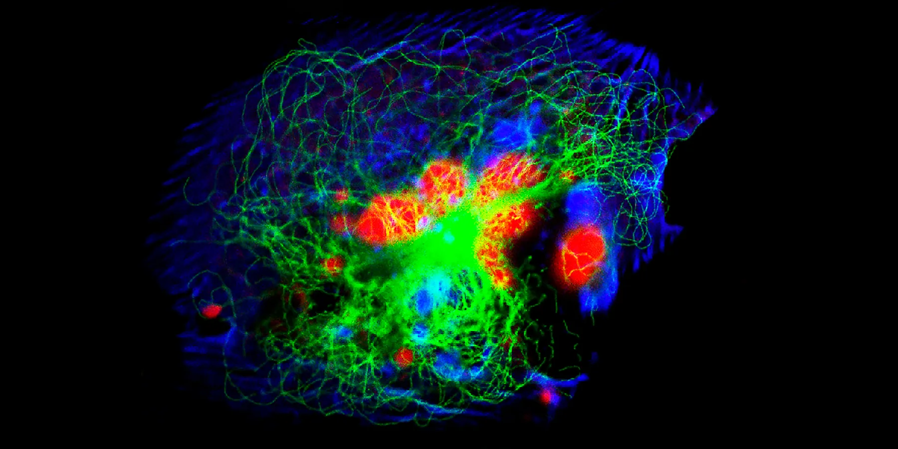 A fluorescence microscopic view of human neuroblastoma cells.