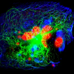 A fluorescence microscopic view of human neuroblastoma cells.